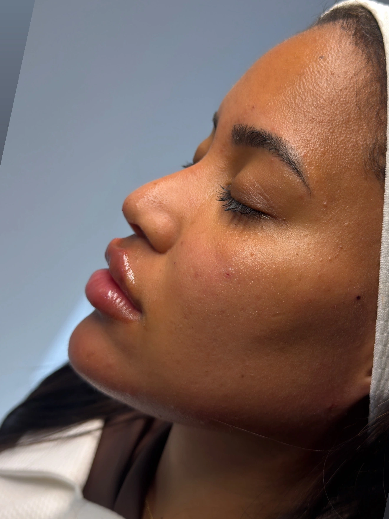 Estética Facial